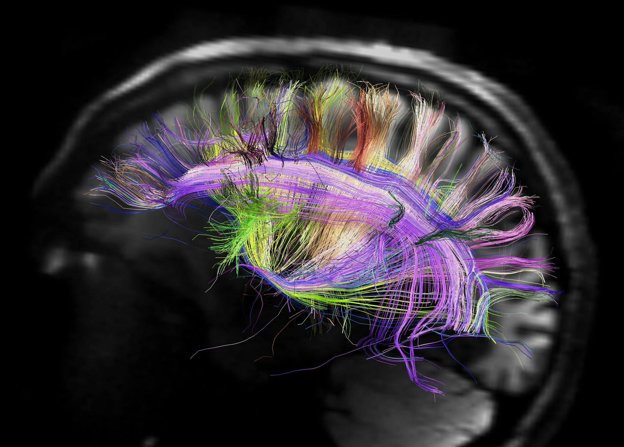 Human Connectome Project post photo